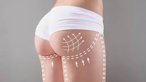 Quels sont les bons candidats à une. Lipofilling Fesses Tunisie Augmentation Fessiers Par Injection De Graisse Prix