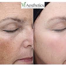 TOP 10 BEST Eyebrow Tinting near Aledo, TX