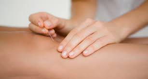 Check spelling or type a new query. Schmerztherapie Elektrotherapie Vermeidet Akupunktur Verzogert