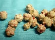 Not all cats with bladder stones show signs of having this problem. Does Your Cat Suffer From Bladder Stones