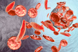 Image result for Anemia angolensis