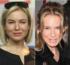 Renee Zellweger's Face — She Got Plastic Surgery, Docs Say