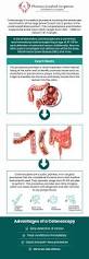 Image result for Colon Cancer Screening with Colonoscopy