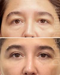 Dr. Benjamín Riesco