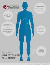 Après une chute de tension, la position néanmoins, si elles se répètent souvent et/ou sont associées à d'autres symptômes comme une fatigue excessive ou un essoufflement, elles peuvent. Hypertension Pulmonaire Institut De Cardiologie De L Universite D Ottawa