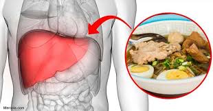 A Mortal Enemy Of Your Liver It S Not Alcohol Food Ginger Benefits Healthy Liver