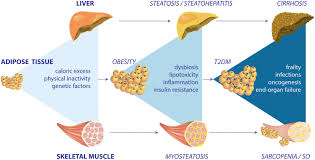 Components of a healthy diet bloom's taxonomy: Skeletal Muscle Dysfunction In The Development And Progression Of Nonalcoholic Fatty Liver Disease