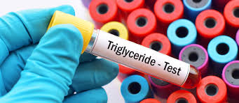 Triglyceride Definition Normwerte Folgen Und Behandlung Zu Hoher Werte