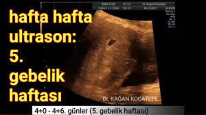 5 gebelik haftasinda anne karnindaki bebek gebelik kesesi ve organlar olusmaya basladi youtube