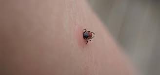 Image result for Tick Removal