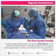 Ust Goz Kapagi Yasla Gevseyip Sarktiginda Blefaroplasti Denen Estetik Ameliyatla Duzeltilir Eger Goz Kapaginda Cilt Fazlaliginin Yanisira Estetik Bilgi Yag