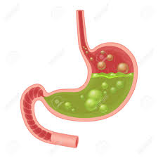 Realistic Medical Illustration Of Nausea Stomach Isolated Green Royalty Free Cliparts Vectors And Stock Illustration Image 102957998 A subreddit for girls stretching themselves to the limit. realistic medical illustration of nausea stomach isolated green