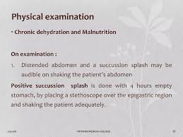 Image result for Succussion Splash