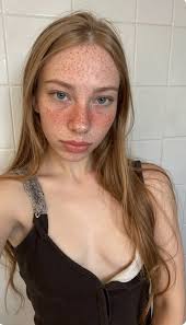 Be honest: Would it embarrass you to have a child with a freckled girl?  Probably yes. I get it. You just want your kids to look normal.