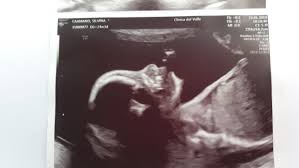 23 Semanas Cuanto Pesan Sus Bebes Club Mayo 2019 Embarazo Y Bebes Babycenter