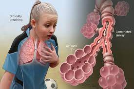Controlling Your Wheezing With Salt Therapy - Home Salt Therapy