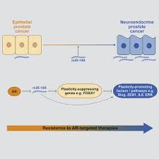 Kristen has worked as a nurse for 19 years, but she knows how important it is to stay up to date with new and effective injection techniques. Post Transcriptional Gene Regulation By Microrna 194 Promotes Neuroendocrine Transdifferentiation In Prostate Cancer Sciencedirect