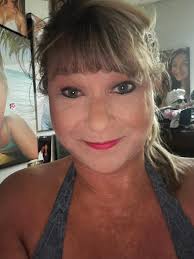 Face-lift and neck-lift results after 2.5 months