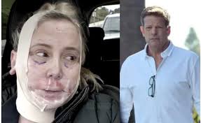 Shannon Beador's Ex John Janssen Denies $75k Facelift Gift Claim