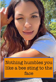 Bee Sting Mishap: A Construction Worker’s Reality