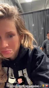 Charlotte Flair Injury Revealed Using Crutches in Public as WWE Fans Are  Worried #WWE #charlotteflair #alexabliss #beckylynch #TiffanyStratton  #SmackDown #wwesmackdown #RicFlair