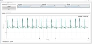 While your vehicle's being fixed, loss of use covers your expenses to rent a vehicle, use taxis and take public transit. Uncategorised