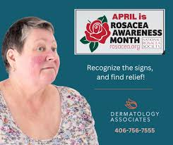 April is Rosacea Awareness Month
