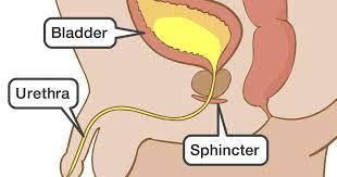 Its hydrophilic coating provides optimal access in transradial and complex cases. Clean Intermittent Catheterization Cic Step By Step Instructions For Boys