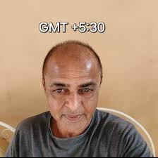 How do you manage storage