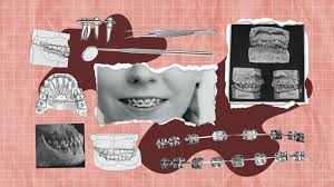 These are good questions, and the answer to them is yes. Evidence And Orthodontics Does Your Child Really Need Braces
