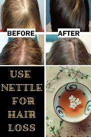A hair tea or hair tea rinse is simply brewing a type of tea, allowing it to steep and cool prior to pouring it over your hair and scalp. How To Use Nettle For Hair Loss Tea Or Tincture Hair Loss Natural Hair Shampoo Hair