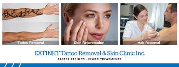 We fade or remove tattoos faster than anyone else with picosure. Extinkt Tattoo Removal Skin Clinic Request An Appointment Laser Hair Removal 9737 Macleod Trail S Calgary Ab Phone Number Yelp
