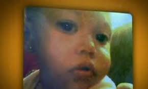 Auxiliar de enfermagem que cortou dedo de menina de 1 ano em SP não será  indiciada