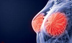Of seven critically ill patients who received the drug in new york, two were removed from ventilators and two showed significant improvement. Leronlimab Moving Toward Breakthrough Designation With Positive Mtnbc Data