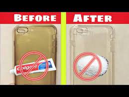 Water, baking soda, toothbrush, and a soft dry cloth to use. Easy Way To Clean Transparent Mobile Cover 10000 Removal Of Yellowness Youtube Diy Mobile Cover Mobile Covers Diy Phone Cover