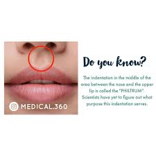 Medical 360 S Instagram Profile Post The Indentation In The Middle Of The Area Between The Nose And The Upper Lip Is In 2020 Upper Lip Medical Knowledge Philtrum