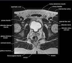 This section of the website will explain large and minute details of sagittal knee cross sectional anatomy. Mri Pelvis Anatomy Free Male Pelvis Axial Anatomy