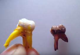 Oh Man Watching What Soda Can Do To Your Teeth Is So Gross Soda Food Articles Soda Can