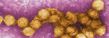 Hautausschlag sowie ausgeprägten gliederschmerzen einher. West Nil Virus Am Oberrhein Infizierte Vogel Und Pferde Als Indikatoren Fur Erhohtes Risiko Medical Tribune