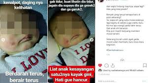 Pemicunya sendiri bisa banyak hal, antara lain kelenjar keringat yang terlalu aktif, penyakit kronis, ketidakseimbangan hormon dan adanya infeksi dalam tubuh. Asi Mampu Tangkal Penyakit Kulit Kronis Pada Bayi Ryuzio Yang Dipegang Banyak Orang Tribunnews Com Mobile