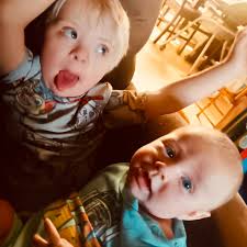 Down Syndrome Child Meets Santa