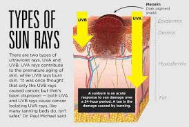 People most at risk of melanoma have fair skin and hair, blue later development of skin cancer is linked to childhood sunburn. What S Happening Below The Surface Of Your Sunburn Southern Hills Hospital Medical Center