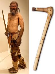A thorough scan of ötzi the iceman's mummified body determined that his 61 tattoos served a medical purpose. The Iceman Goeth Earthdate