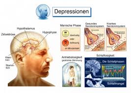 Depressive Verstimmung Ursachen Symptome Behandlung Medlexi De