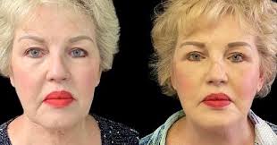 Michael Schwartz (@michaelschwartzmd) • Instagram photos and videos