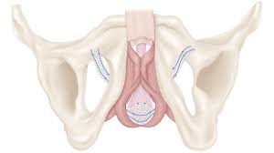 Image result for Stress Incontinence