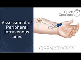 Image result for Peripheral IV Access