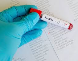 Maybe you would like to learn more about one of these? Soa Poli Amsterdam Weigert 2 600 Mensen Radar Het Consumentenprogramma Van Avrotros