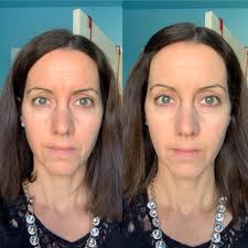 What is great about Dewey foundation?