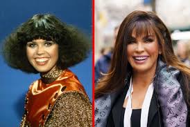Marie osmond plastic surgery before & after. Qpzepqsupwnddm